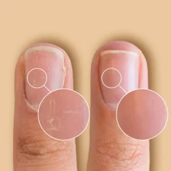 Essentials Care Pen Solaroil